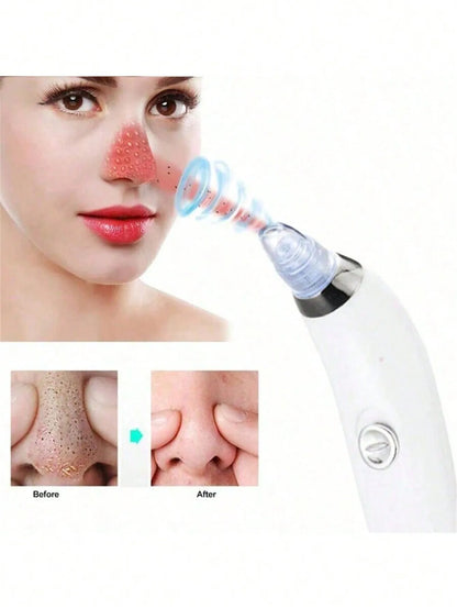 Electric Suction Blackhead Remover