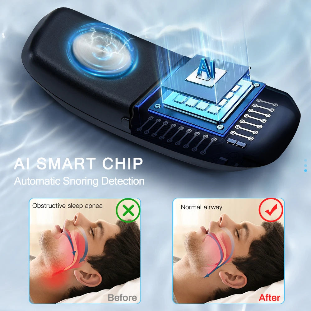 USB Smart Anti-Snoring Device