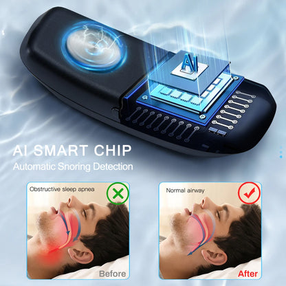 USB Smart Anti-Snoring Device