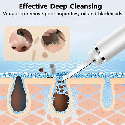 Ultrasonic Skin Scrubber & Pore Cleaner