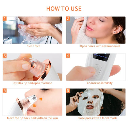 Nose Blackhead Remover