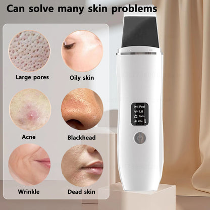 Ultrasonic Skin Scrubber & Pore Cleaner