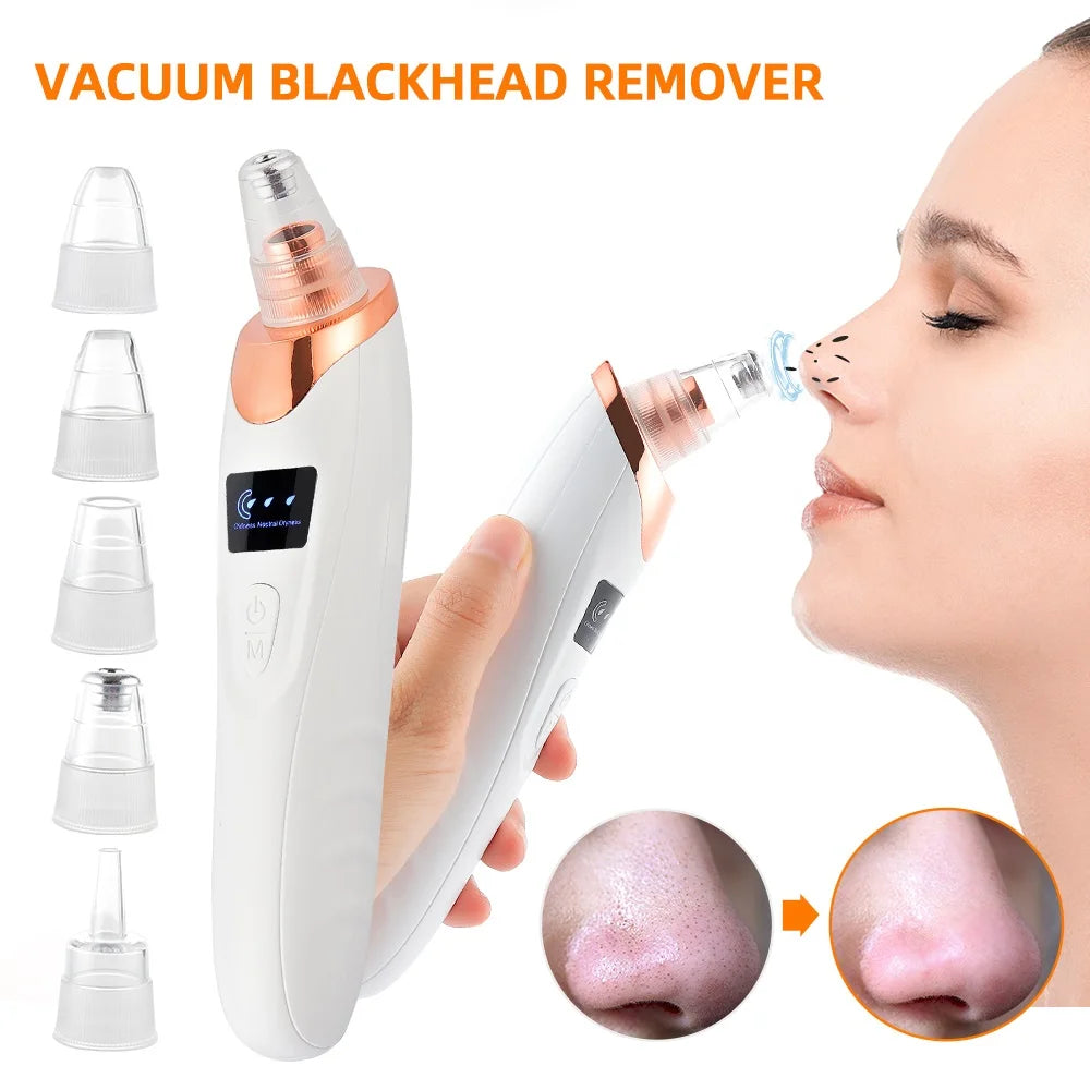 Nose Blackhead Remover